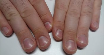 El verano aumenta los riesgos para la salud de las uñas, advierten expertos